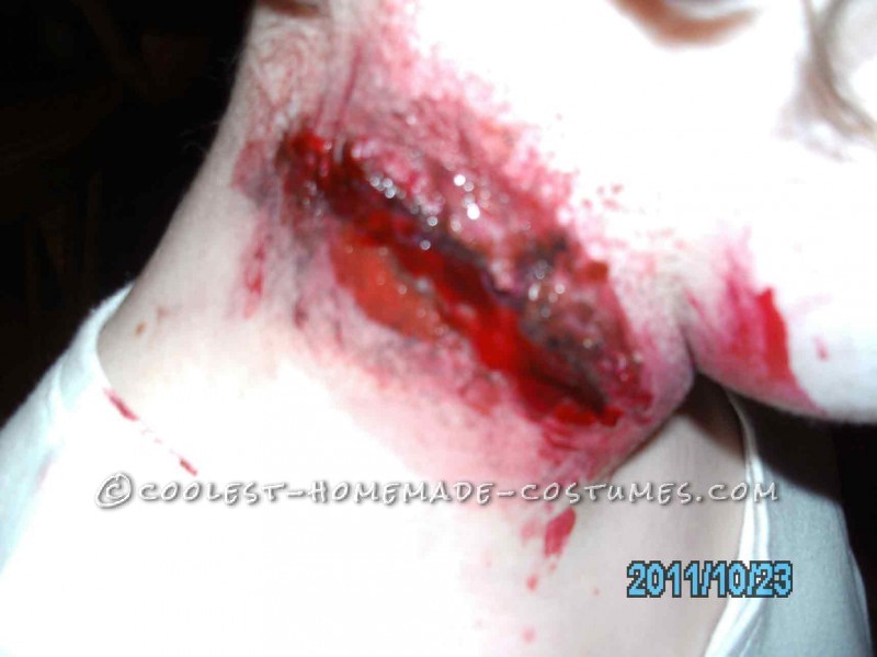 herida en el cuello